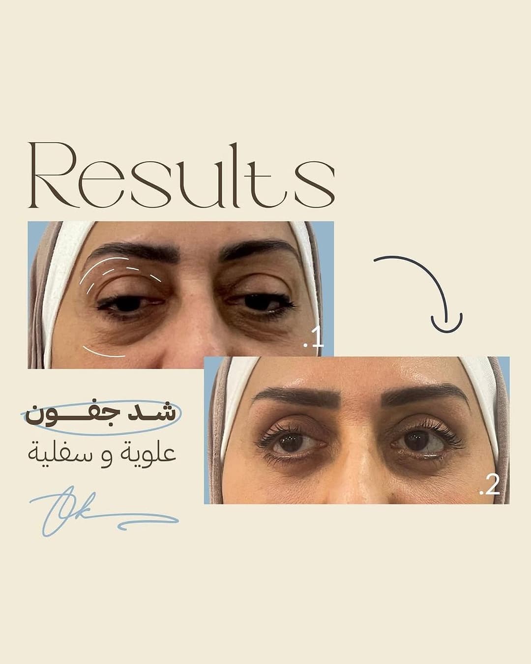 Result 21